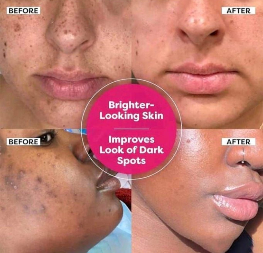 Dark Spot Correcting Glow Serum